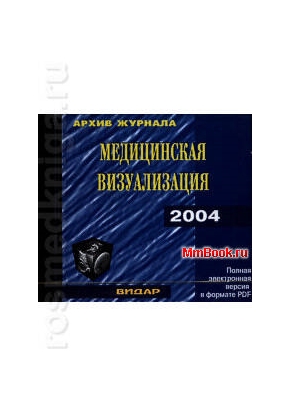 CD Архив журнала Медицинская визуализация за 2004г.