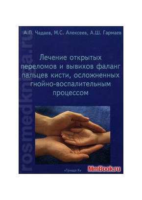 Лечение открытых переломов и вывихов фаланг пальцев кисти, осложненных гнойно-воспалительным процессом