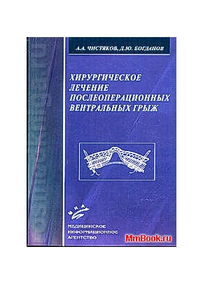 Хирургическое лечение послеоперационных вентральных грыж