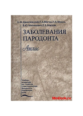 Заболевания пародонта атлас