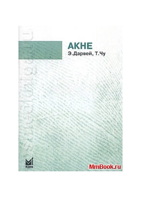 Акне: карманный справочник