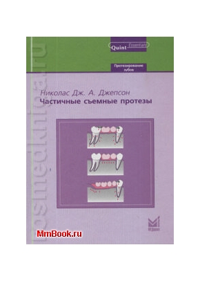 Частичные съемные протезы