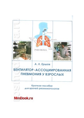 Вентилятор-ассоциированная пневмония у взрослых: краткое пособие