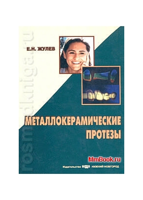 Металлокерамические протезы