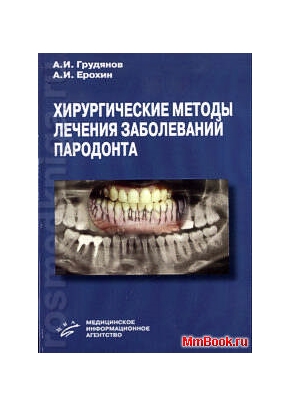 Хирургические методы лечения заболеваний пародонта