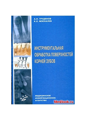 Инструментальная обработка поверхностей корней зубов