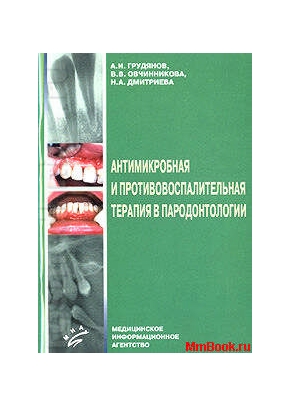 Антимикробная и противовоспалительная терапия в пародонтологии