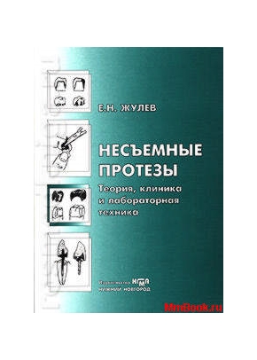 Несъёмные протезы