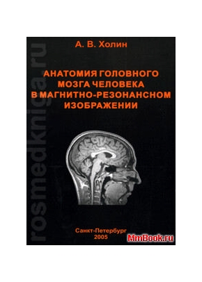 Анатомия мозга человека в магнитно-резонансном изображении