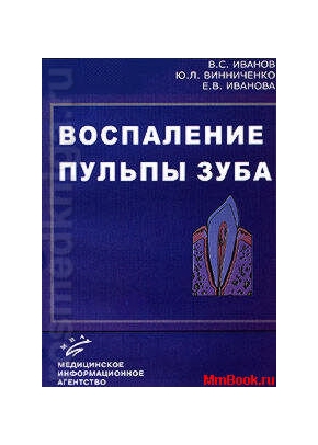 Воспаление пульпы зуба