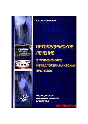 Ортопедическое лечение с применением металлокерамических протезов