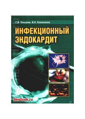 Инфекционный эндокардит