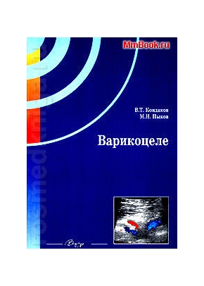 Варикоцеле