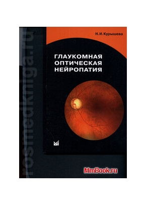 Глаукомная оптическая нейропатия