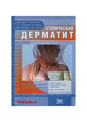 Атопический дерматит