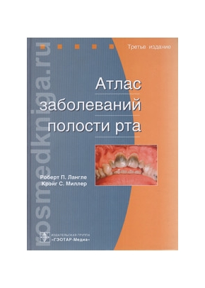 Атлас заболеваний полости рта