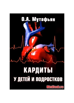 Кардиты у детей и подростков