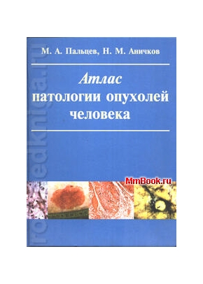 Пальцев М. А., Аничков Н. М. - Атлас патологии опухолей человека