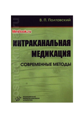 Интраканальная медикация. Современные методы