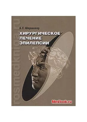 Хирургическое лечение эпилепсии