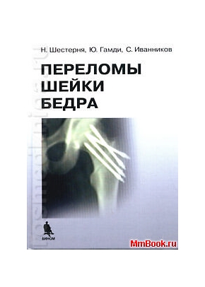 Переломы шейки бедра. Современные методы лечения