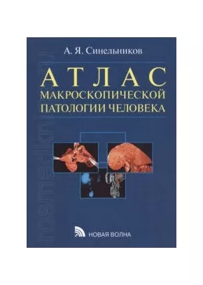 Атлас макроскопической патологии человека