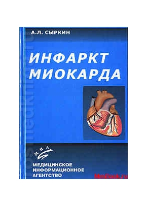 Инфаркт миокарда