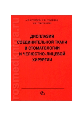 Дисплазия соединительной ткани в стоматологии