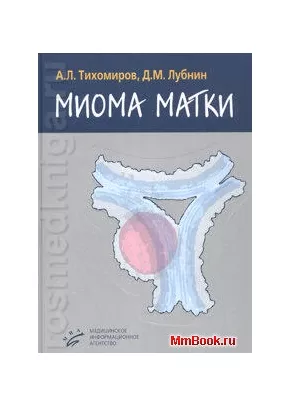 Миома матки