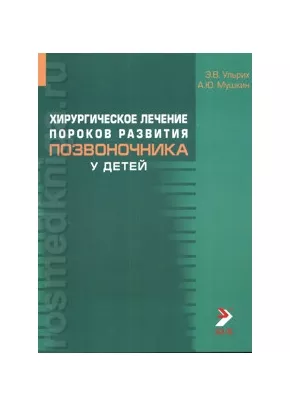 Хирургическое лечение пороков развития позвоночника у детей