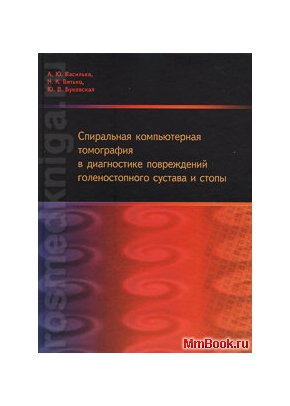 Спиральная компьютерная томография в диагностике повреждений голеностопного сустава и стопы