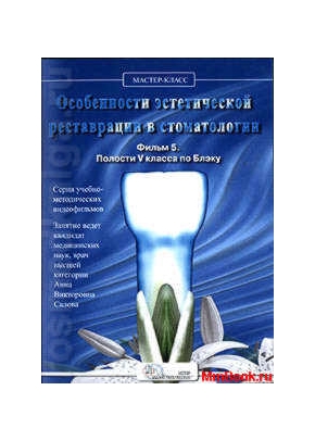 Особенности эстетической реставрации в стоматологии Фильм 5 (полости 5 класса)