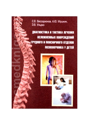 Диагностика и тактика лечения осложненных повреждений грудного и поясничного отделов позвоночника у детей