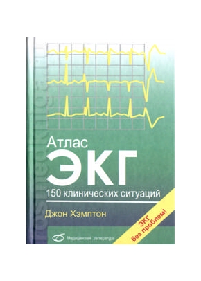 Атлас ЭКГ. 150 клинических ситуаций