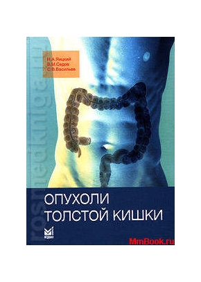 Опухоли толстой кишки