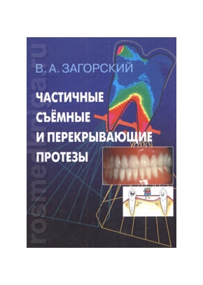 Частичные съемные и перекрывающие протезы