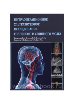Интраоперационное ультразвуковое исследование головного и спинного мозга