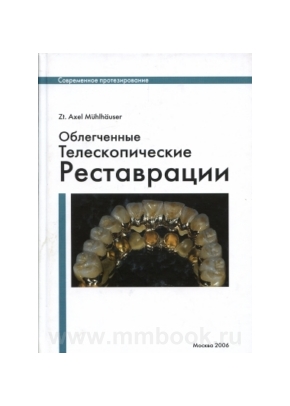 Облегченные телескопические реставрации
