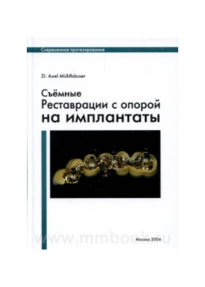 Съемные реставрации с опорой на импланты