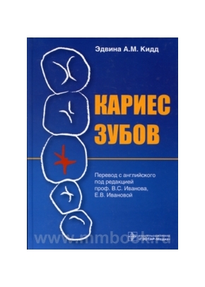 Кариес зубов