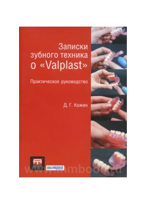 Записки зубного техника о Valplast