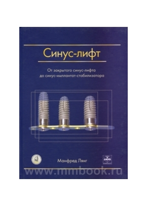 Синус-лифт. От закрытого синус-лифта до синус-имплантат стабилизатора