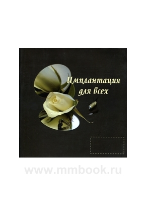 Имплантация для всех. Пособие для пациентов