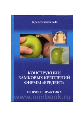 Конструкции замковых креплений фирмы Bredent. Теория и практика