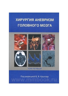 Хирургия аневризм головного мозга в 3-х томах том -1