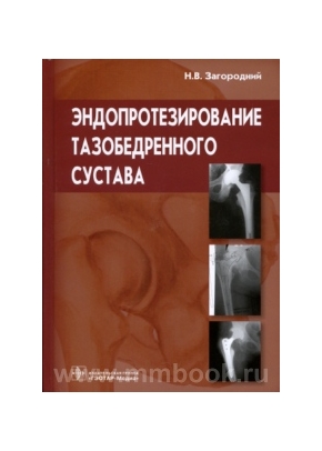 Эндопротезирование тазобедренного сустава. Основы и практика: руководство