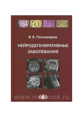 Нейродегенеративные заболевания