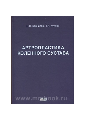 Артропластика коленного сустава