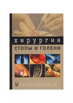Хирургия стопы и голени: практическое руководство