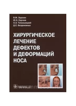 Хирургическое лечение дефектов и деформаций носа